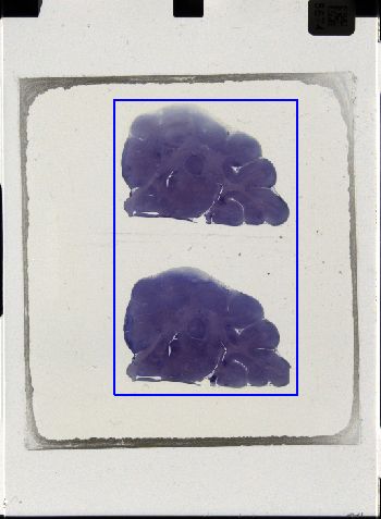 Media type: image; Special Collections 3043   shows specimen_part histological serial section;